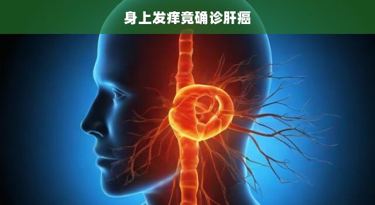 身上发痒竟确诊肝癌