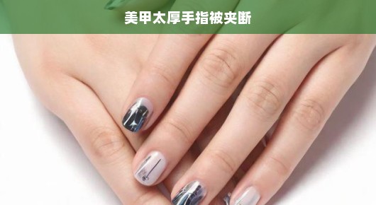 美甲过厚导致意外，手指遭夹断，紧急求助！请速关注，刻不容缓！
